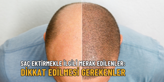 saç ekimi